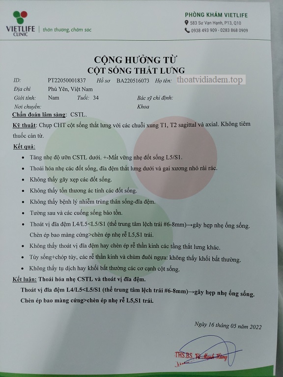 Thoát vị đĩa đệm thắt lưng, đau bên trái